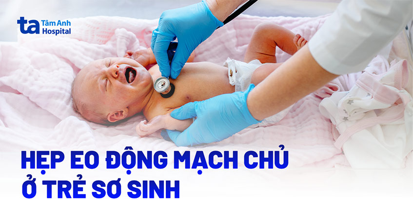 Hẹp eo động mạch chủ ở trẻ sơ sinh
