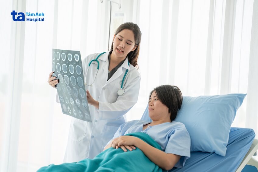 hình ảnh chẩn đoán u sọ hầu