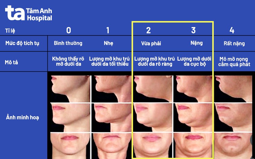 phân độ nọng cằm