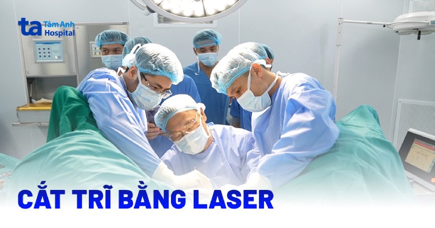 phẫu thuật trĩ bằng laser