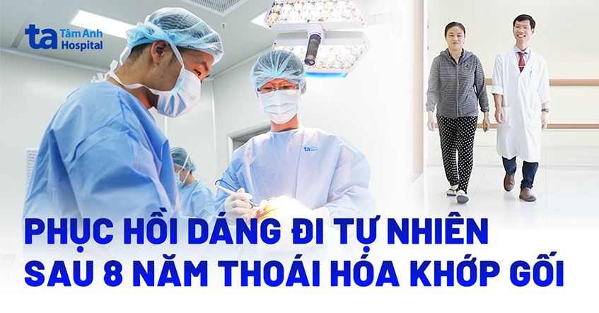 Phục hồi dáng đi tự nhiên sau 8 năm thoái hóa khớp gối