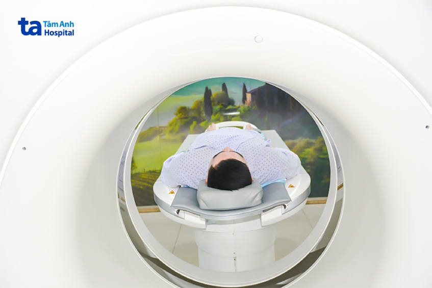 quy trình chụp ct mạch máu não