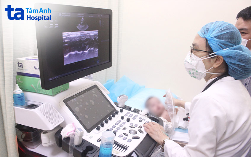 Siêu âm tim giúp phát hiện các bất thường về tim, giúp chẩn đoán hẹp eo động mạch chủ ở trẻ sơ sinh