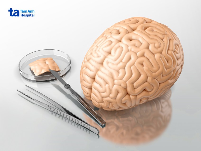 sinh thiết não chẩn đoán bệnh gì