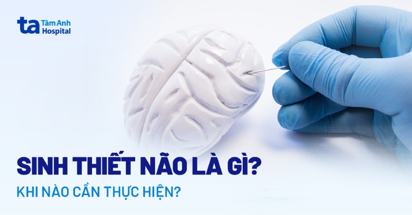 Sinh thiết não là gì? Khi nào cần thực hiện và quy trình ra sao?