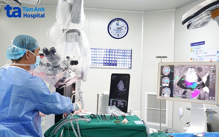 thoát án tử ung thư sau mổ não bs phẫu thuật