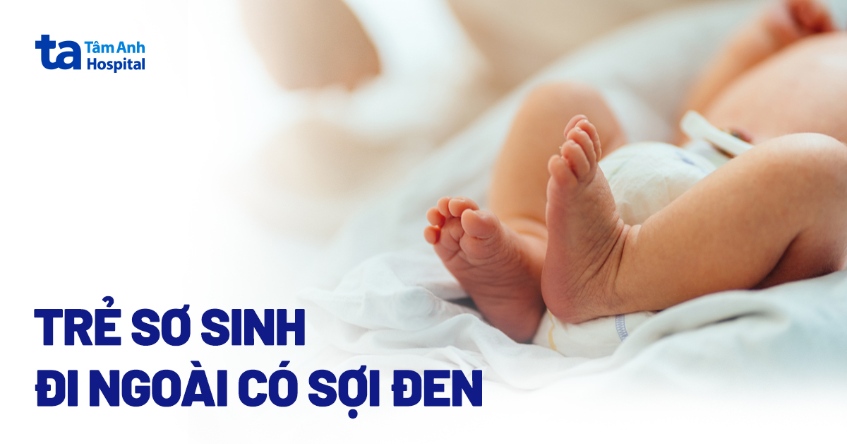 Trẻ sơ sinh đi ngoài có sợi đen: Nguyên nhân và cách chăm sóc