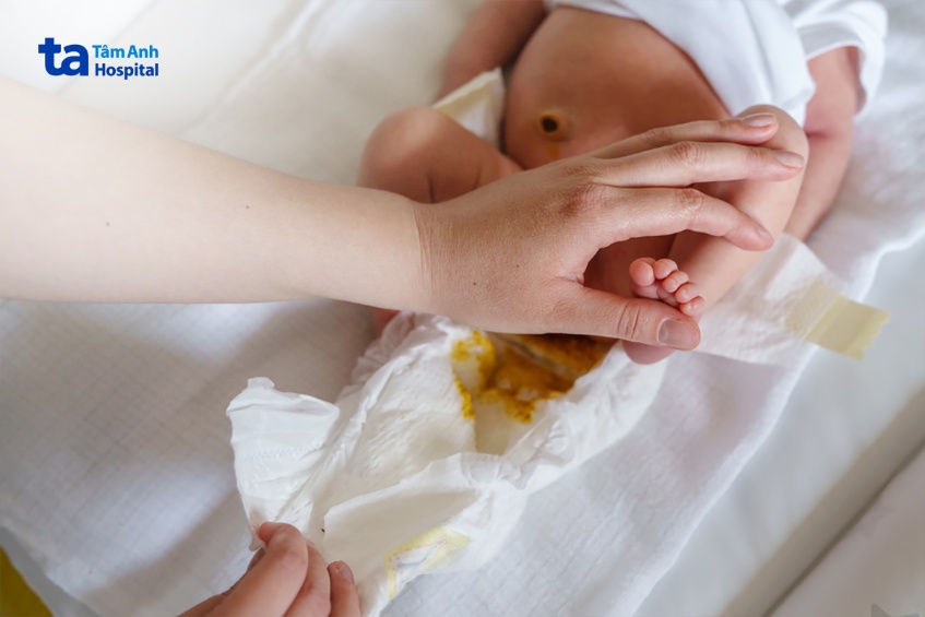 trẻ sơ sinh đi ngoài có sợi