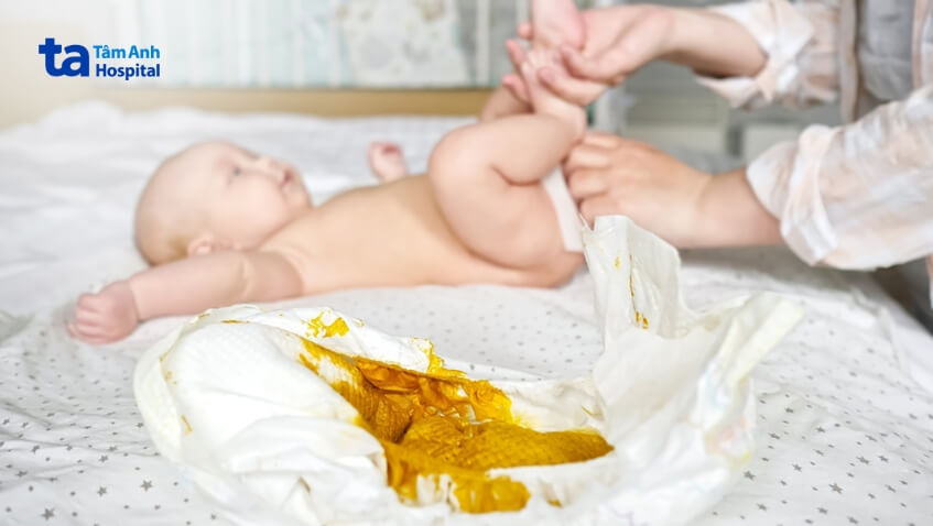 trẻ sơ sinh đi ngoài phân xanh