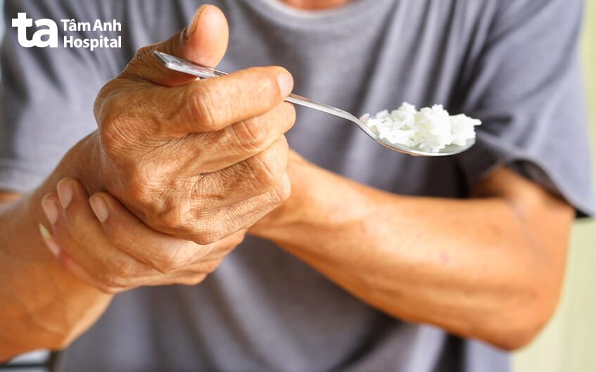 triệu chứng bệnh Parkinson giai đoạn đầu