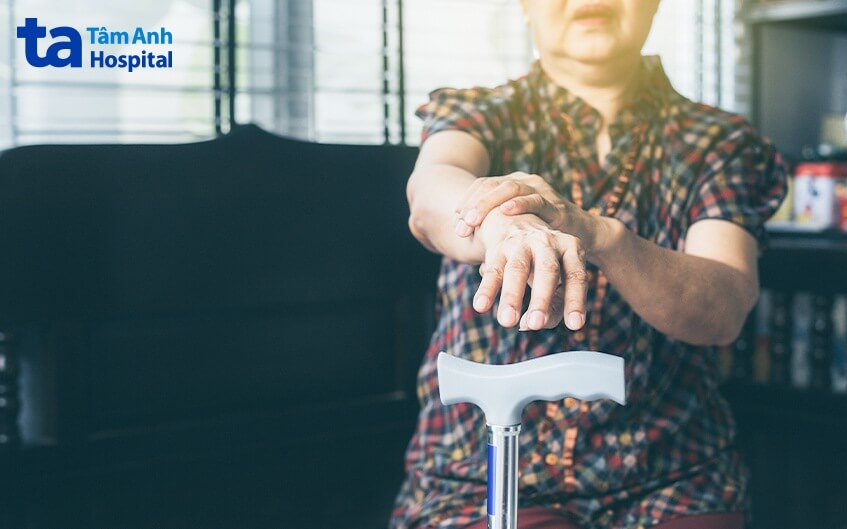 triệu chứng các giai đoạn bệnh parkinson