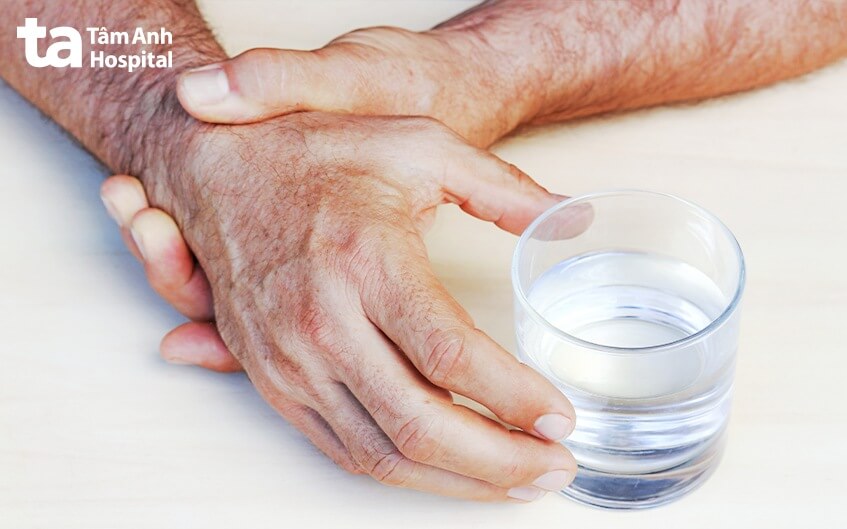 triệu chứng giai đoạn bệnh parkinson