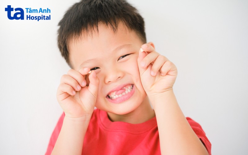 Trẻ thay răng sớm hoặc muộn có sao không?