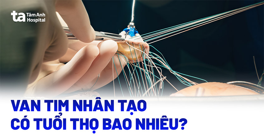 Van tim nhân tạo: 2 loại thường gặp và cách lựa chọn van phù hợp