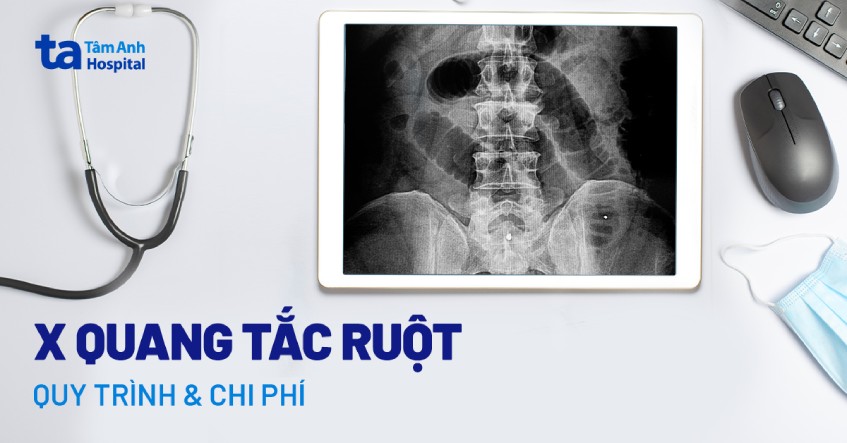 xquang tắc ruột