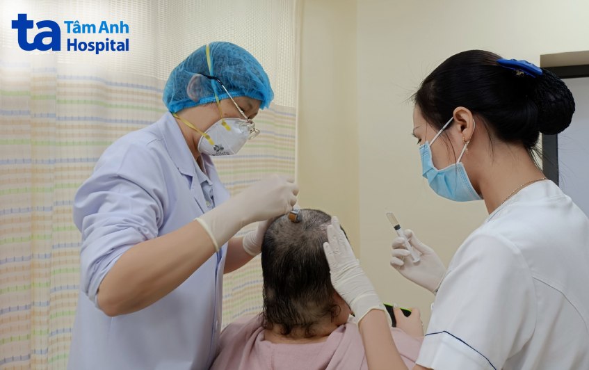 bác sĩ thực hiện lăn kim điều trị rụng tóc