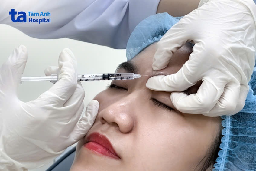 bác sĩ tiêm botox xóa nhăn cho khánh hàng