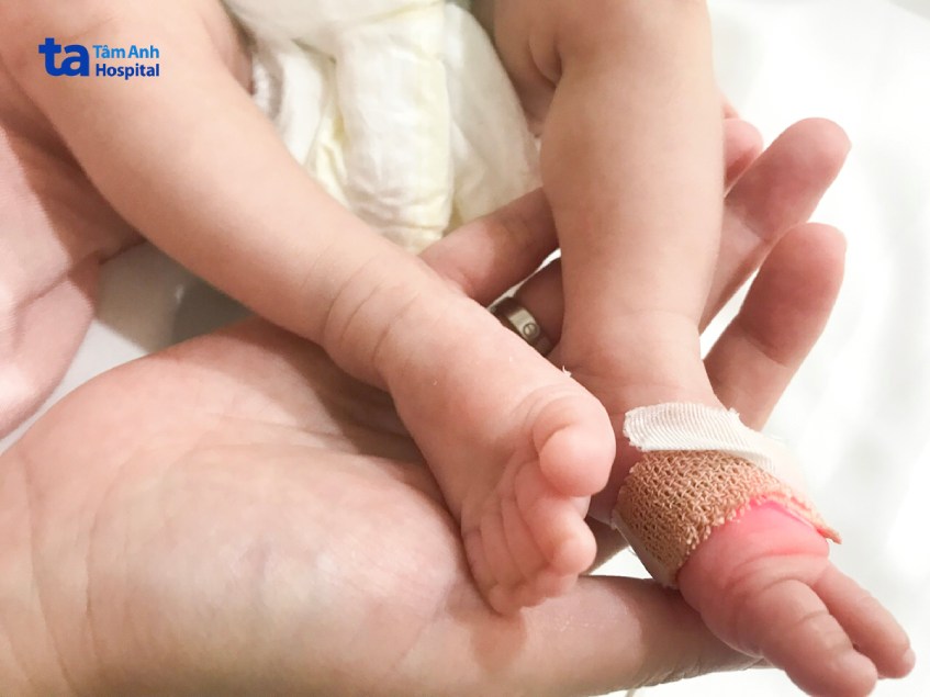 Bàn chân bé nhỏ của con gái chị Quyên lúc xuất viện