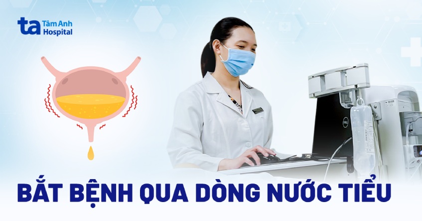 bắt bệnh cho bệnh nhân qua dòng nước tiểu
