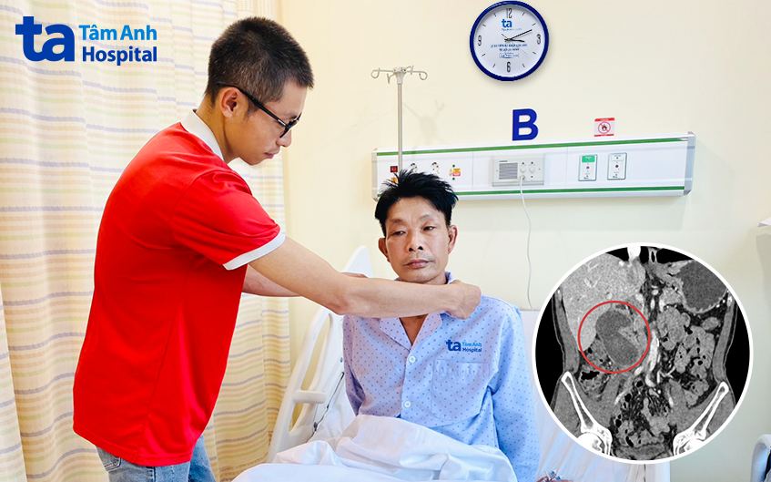 bệnh nhân bị nang ruột