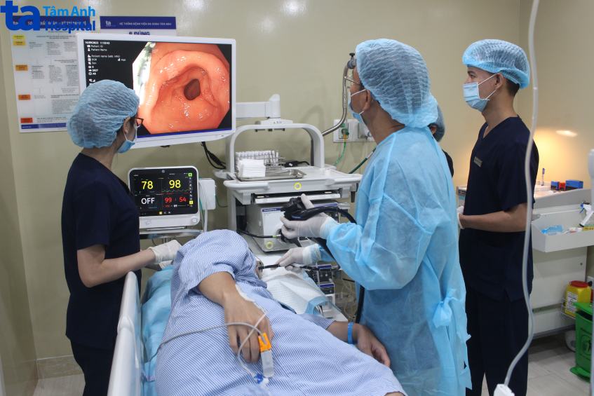 ca nội soi bao tử