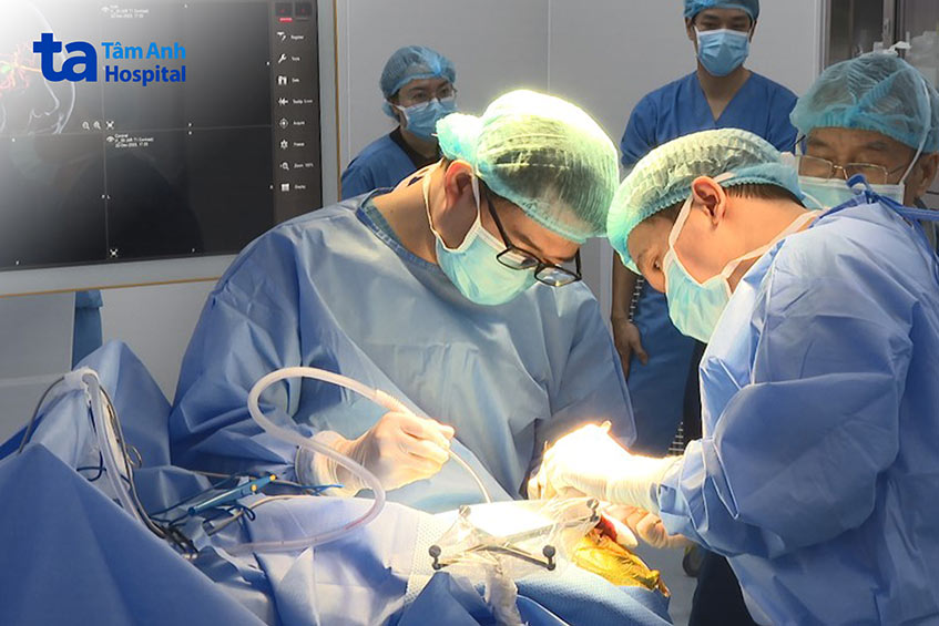 Các bác sĩ phẫu thuật lấy toàn bộ khối u màng não