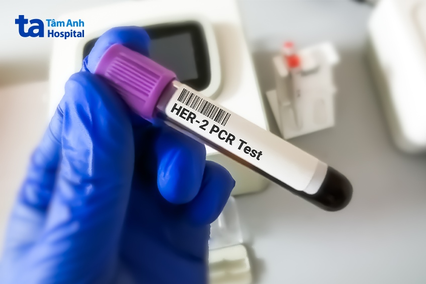 cách chữa ung thư vú HER2 thấp