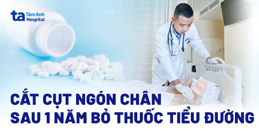 Cắt cụt ngón chân sau 1 năm bỏ điều trị đái tháo đường