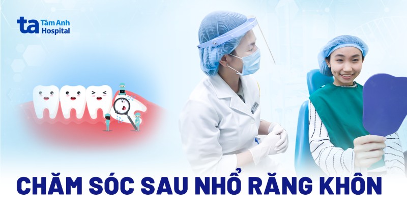 chăm sóc sau nhổ răng khôn