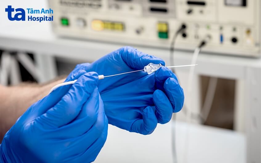 chi phí đốt sóng cao tần rfa