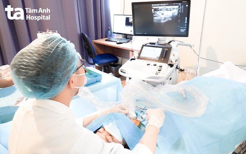 chi phí đốt sóng cao tần tại bvđk tâm anh