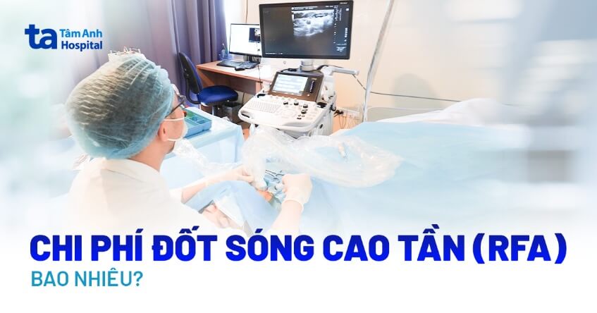 chi phí đốt sóng cao tần