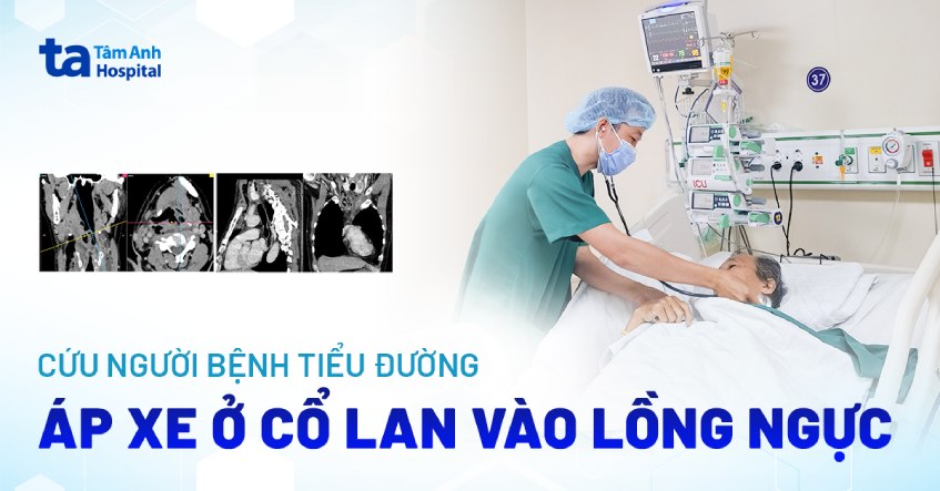Cứu bệnh nhân đái tháo đường mủ lan rộng