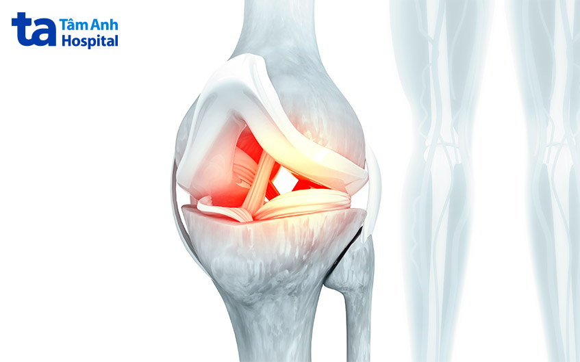 dây chằng là gì