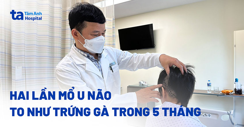 Hai lần mổ u não to như trứng gà trong 5 tháng