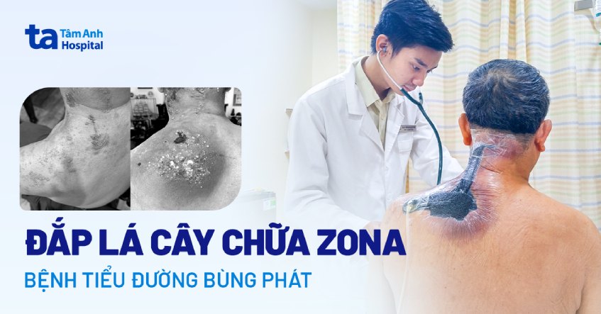 Khám nhiễm trùng da phát hiện tiểu đường