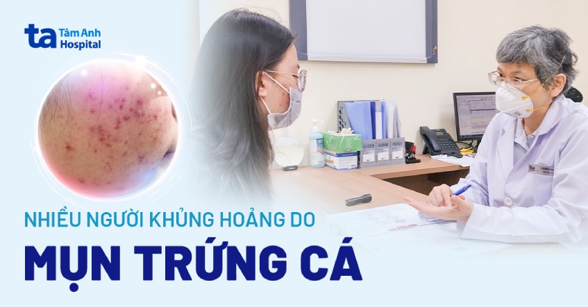 khủng hoảng tâm lý do mụn trứng cá