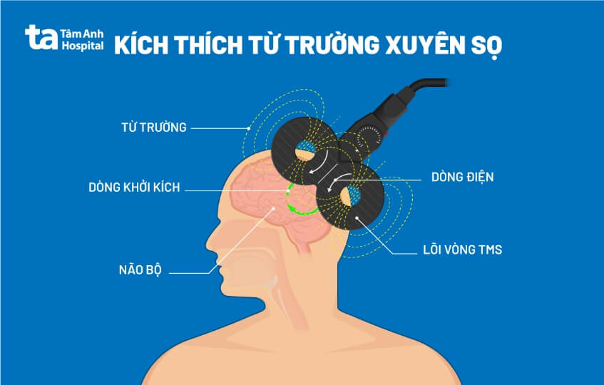 kỹ thuật kích thích từ trường xuyên sọ