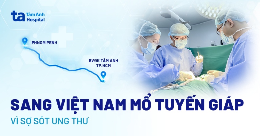 Sang Việt Nam mổ tuyến giáp do sợ sót tế bào ung thư