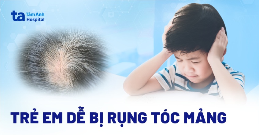 nhiều trẻ em đối diện nguy cơ hói đầu vĩnh viễn