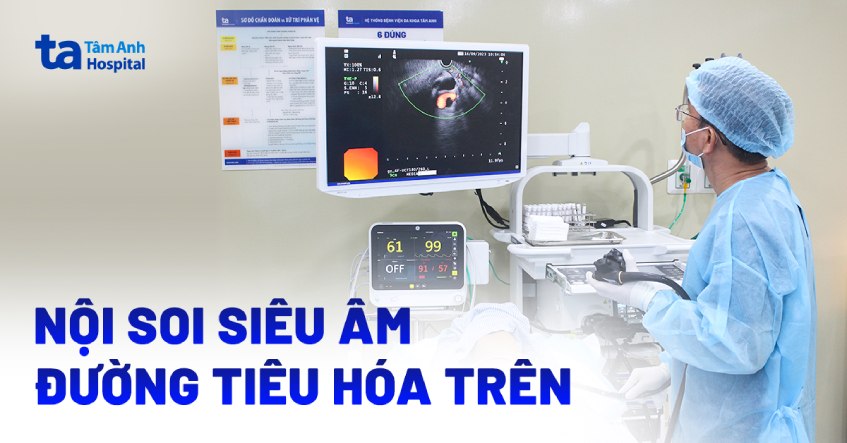 Nội soi siêu âm đường tiêu hóa trên: Quy trình thực hiện