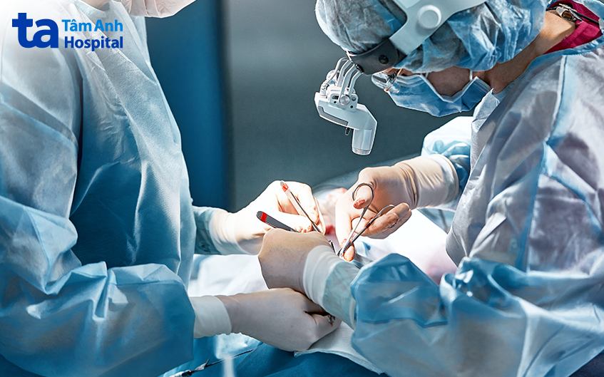 phẫu thuật cắt bỏ túi mật