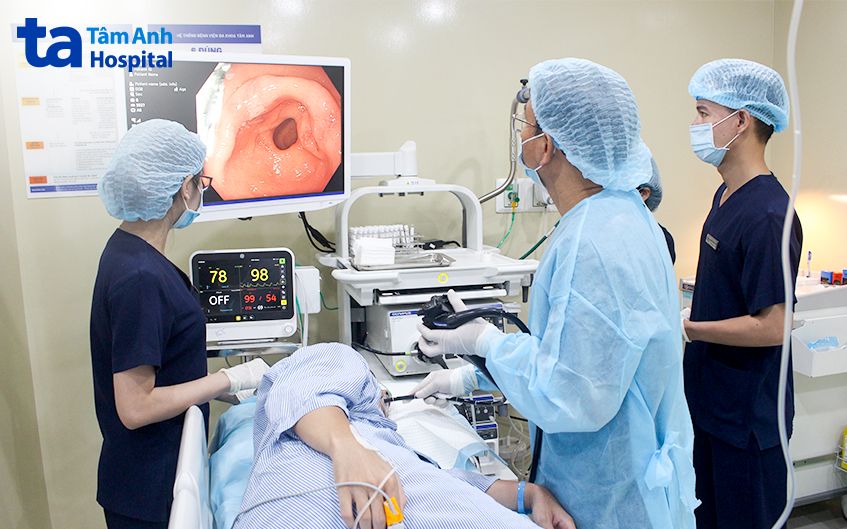 quy trình nội soi siêu âm đường tiêu hóa trên
