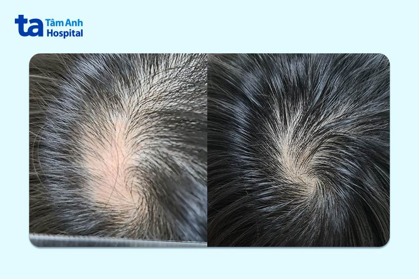 sau 4 tháng điều trị của trẻ