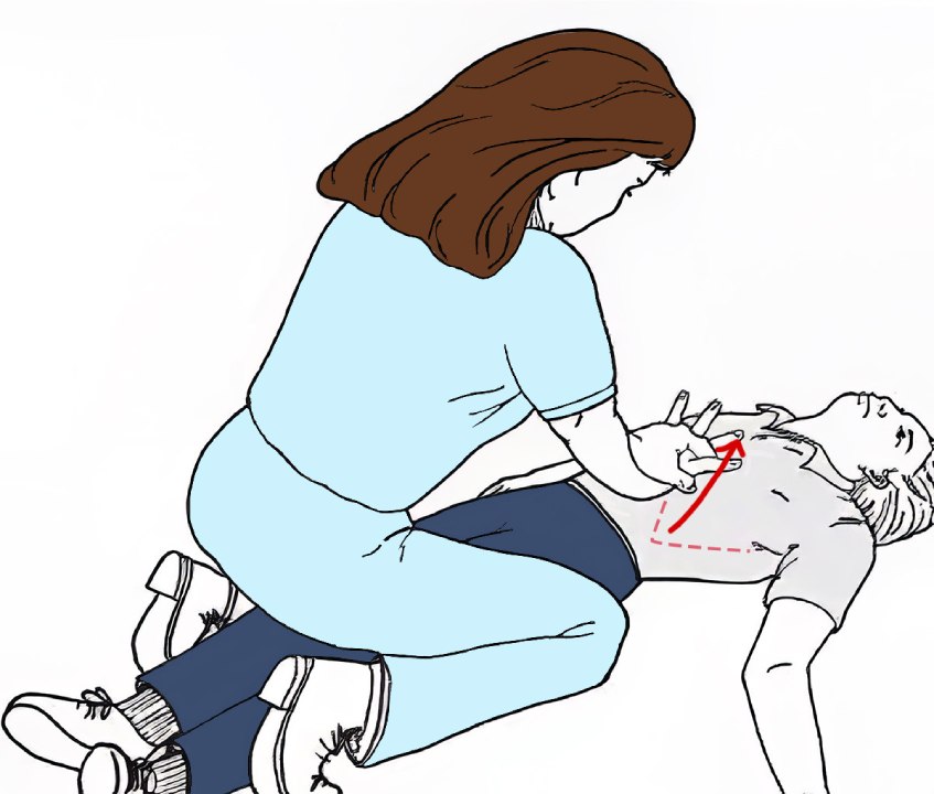 sơ cứu