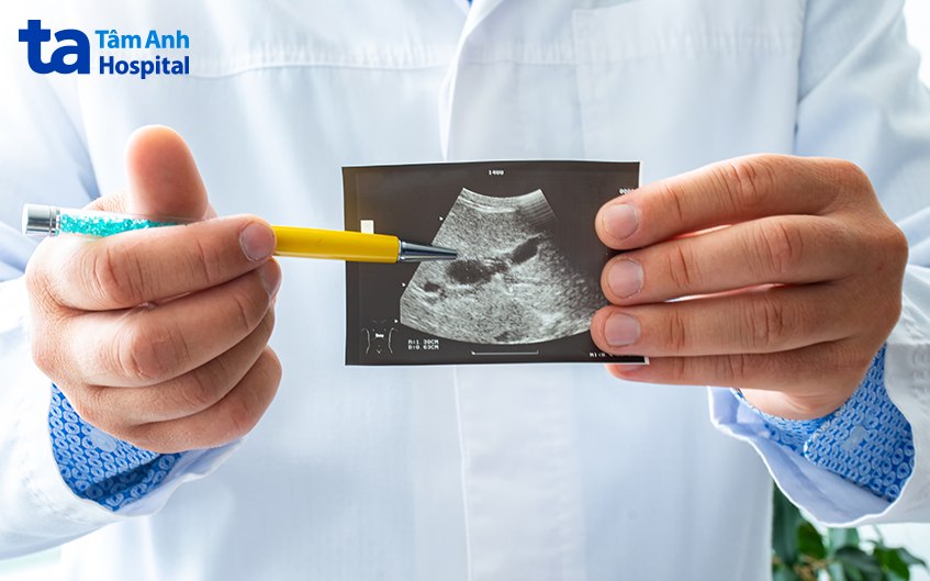 thành túi mật bị dày