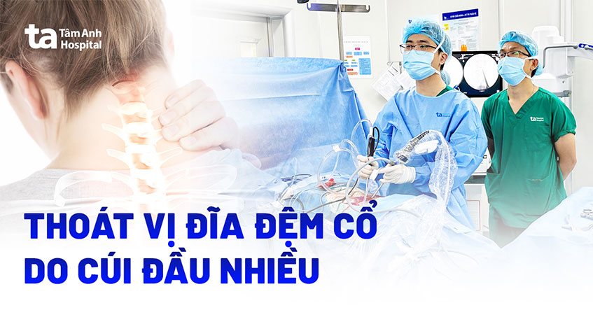 Thoát vị đĩa đệm cổ do cúi đầu nhiều