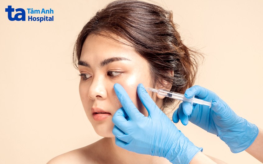 tiêm tan filler có tác dụng gì
