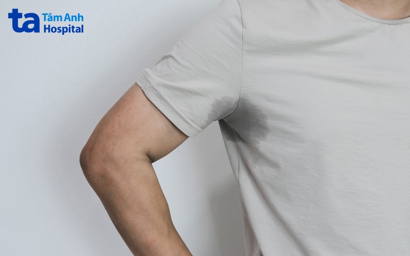 tình trạng tăng tiết mồ hôi nách ảnh hưởng sinh hoạt