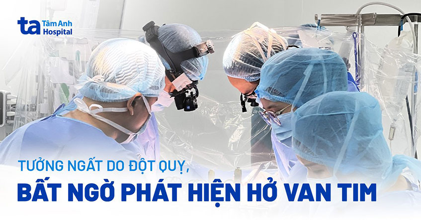 Tưởng đột quỵ hóa bệnh tim